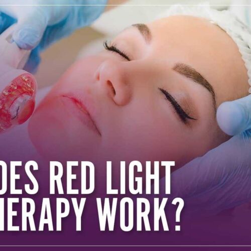 DoesRedLightTherapyWork